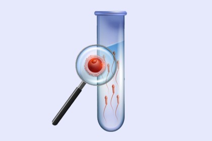 Insemination and fertilization